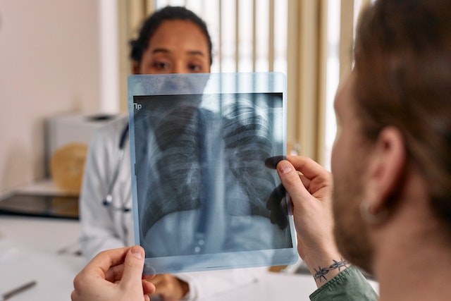 man looking at his X-ray after an accident