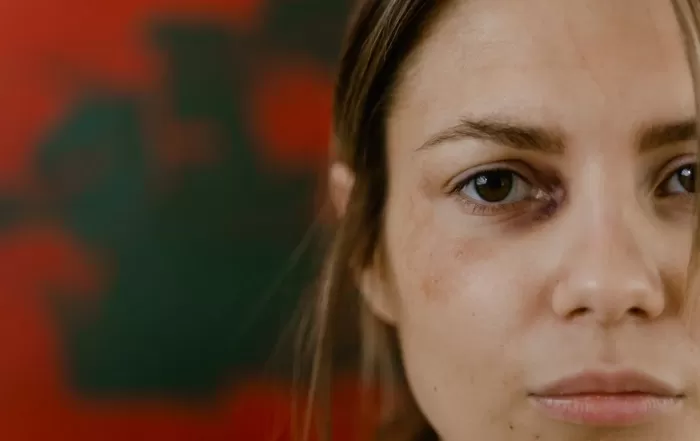 close-up shot of woman with black eye