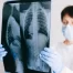 A doctor examining a chest X-ray showing the rib cage